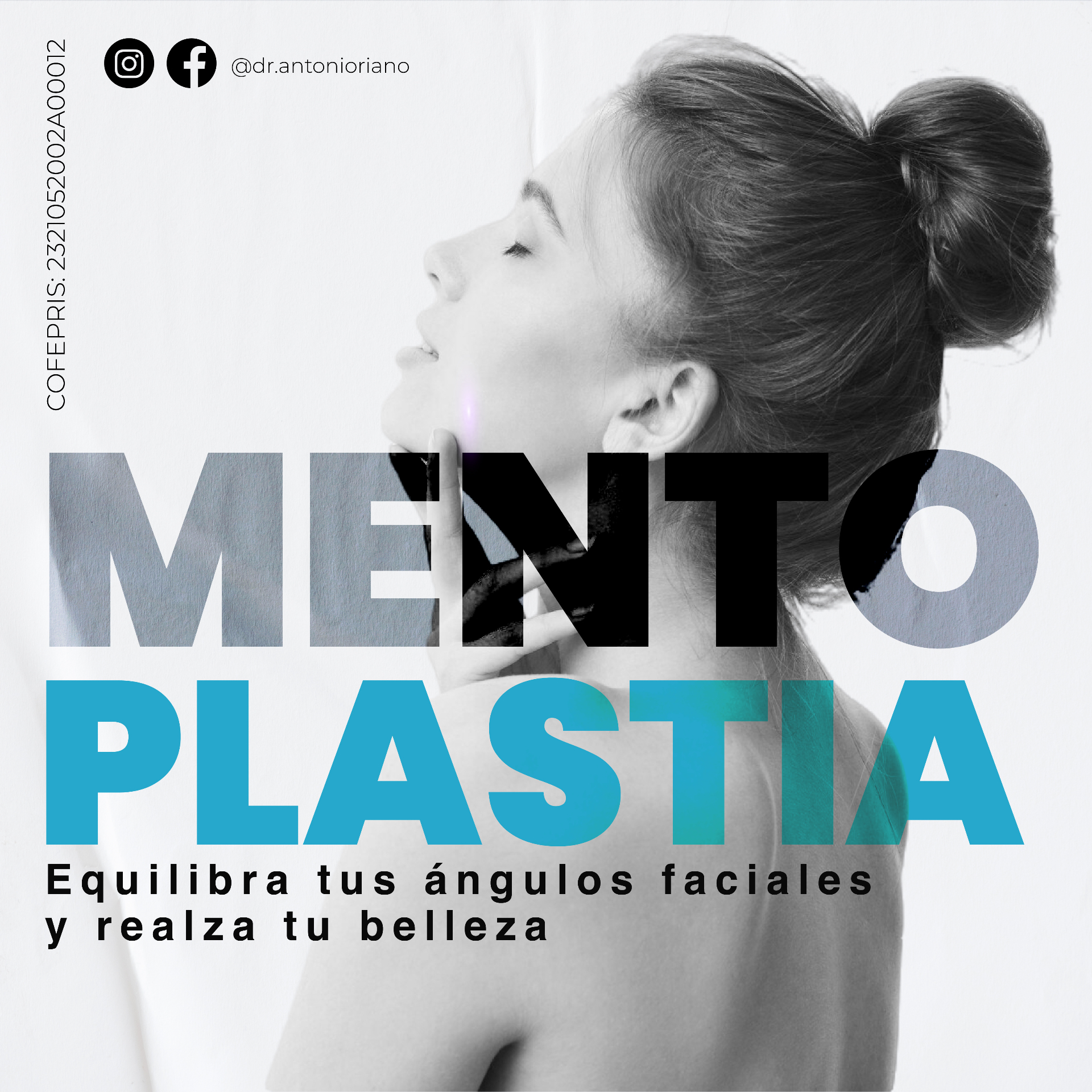 Mentoplastia — Dr. Jesús Antonio Riaño, cirujano plástico en Puebla