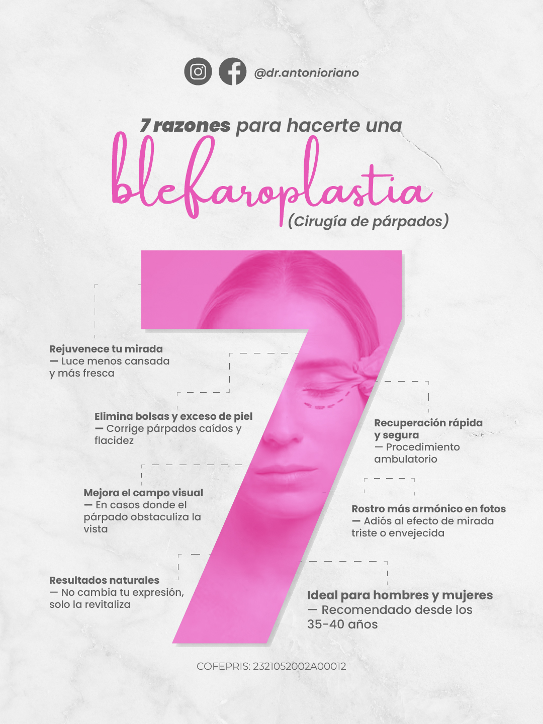 7 razones para hacerte una blefaroplastia — Dr. Antonio Riaño
